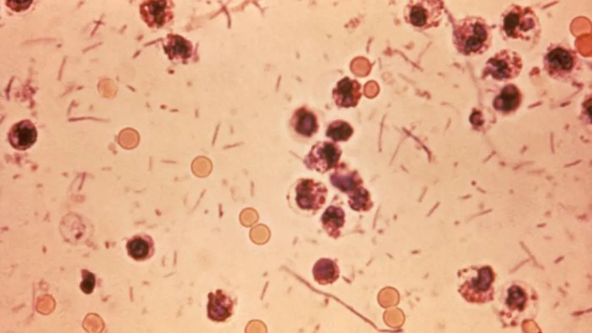 Shigellosis Sickens Hundreds in Ohio as Drug-Resistant Strains Spread, Health Officials Warn